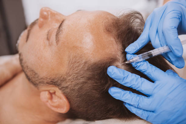 Regenerative Hair Restoration and PRP Therapy